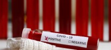 ДВАНАЕСТИ СЛУЧАЈ КОРОНАВИРУСА НА УБУ