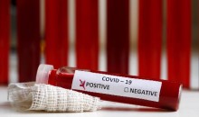 ДВАНАЕСТИ СЛУЧАЈ КОРОНАВИРУСА НА УБУ